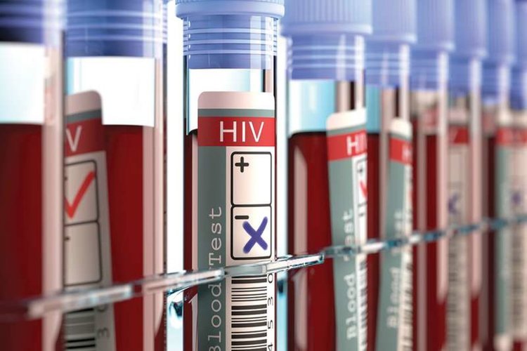 Трети пациент излекуван от ХИВ