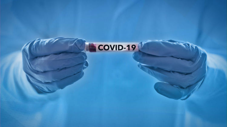 Изследват 89 контактни със семейството, заразено с COVID-19