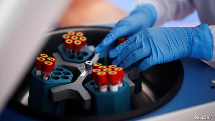 90 нови случая на COVID-19 у нас за денонощие