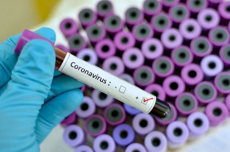 66 за новодиагностицираните с COVID-19 в област Пловдив за последното денонощие