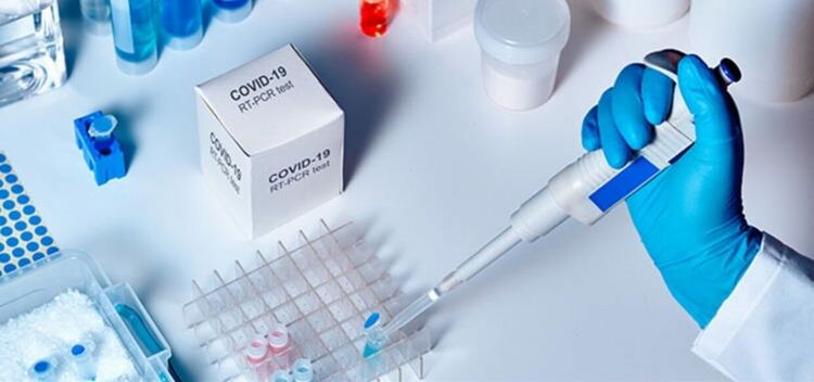 Задължителните PCR тестове ще бъдат безплатни в Турция