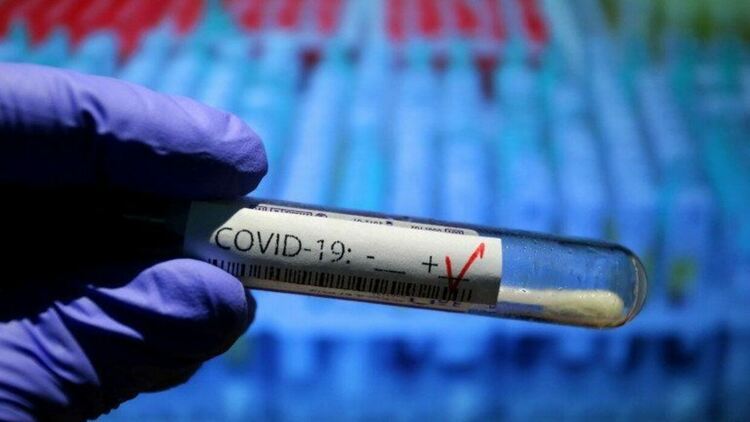 Гърция отчита рекорден брой заразени с COVID-19